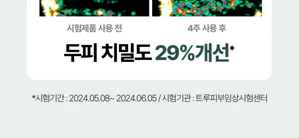 [탈모증상완화] 민트리 두피 샴푸 500ml 상세페이지 13